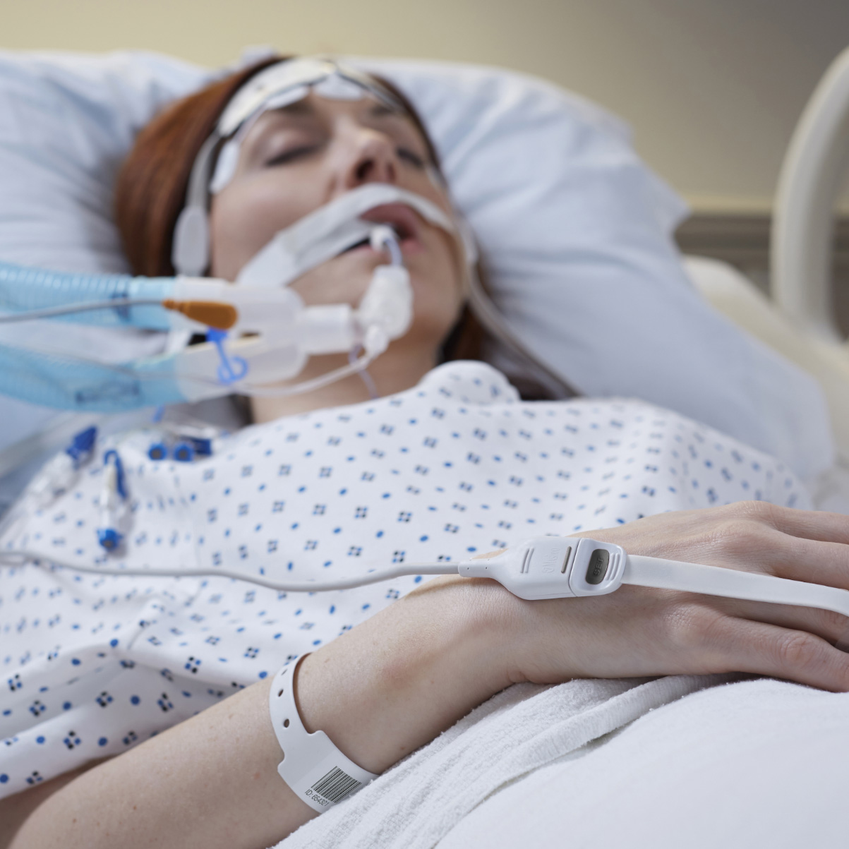 Patient endormi, intubé dans un lit d'hôpital, surveillé par un capteur Masimo RD SET.